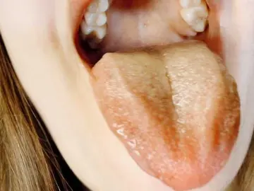 Bongacams Private Sex Chat of hotmiamix