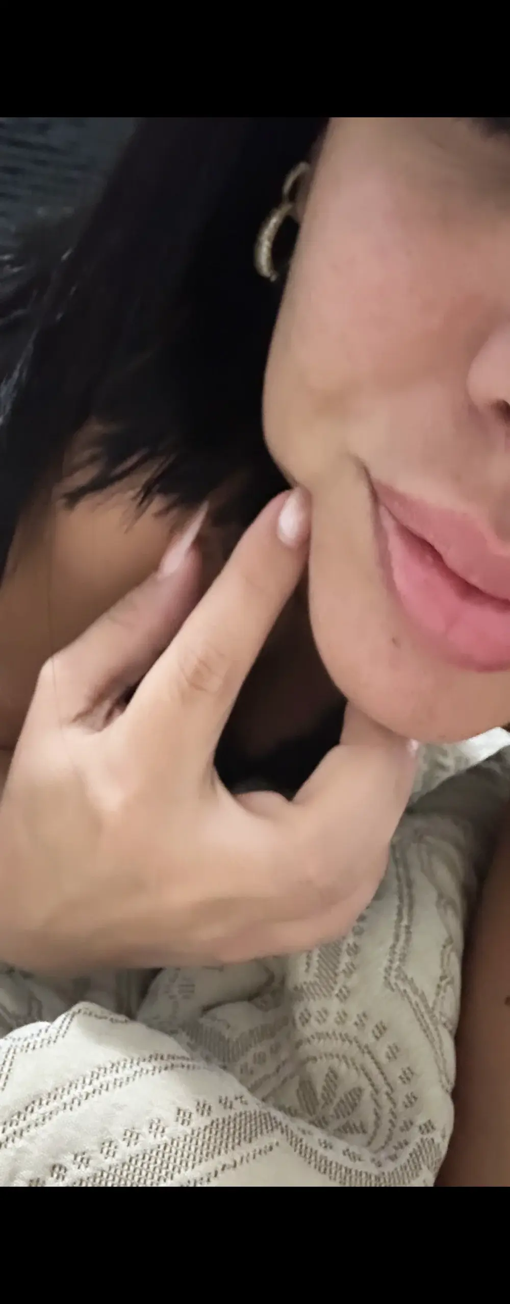 myafontenelle