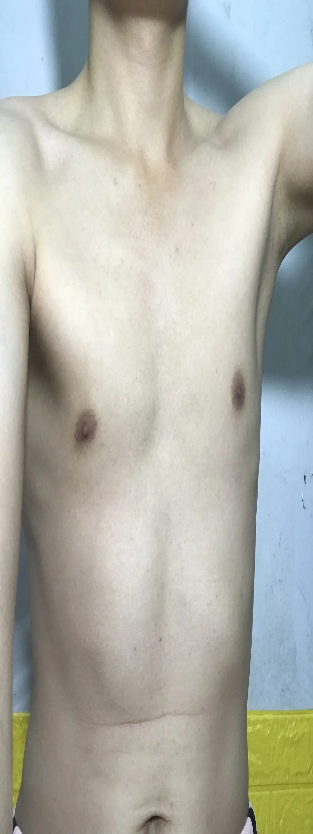 Enda_21